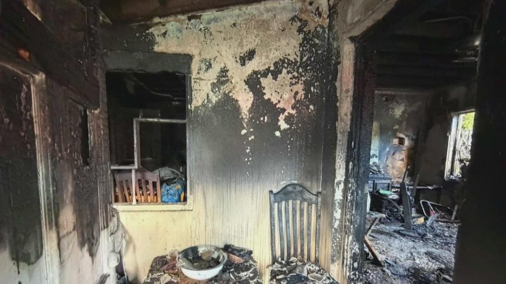 Woman hospitalized after Miami house fire leaves three displaced — CBS Miami, Frisco Health news
